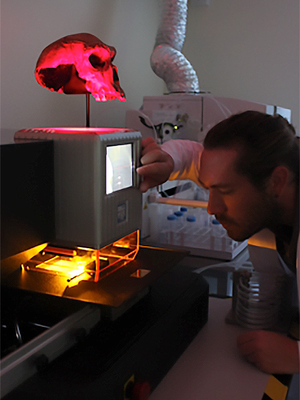 Laser Ablation System